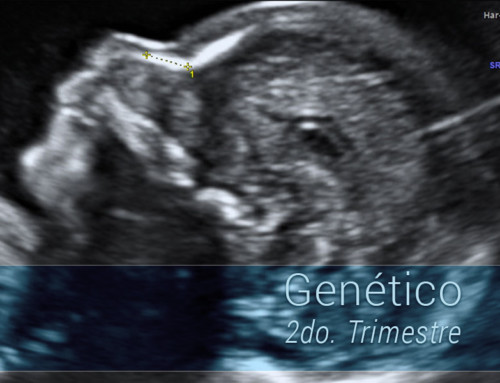 Ultrasonido genético (Segundo trimestre)