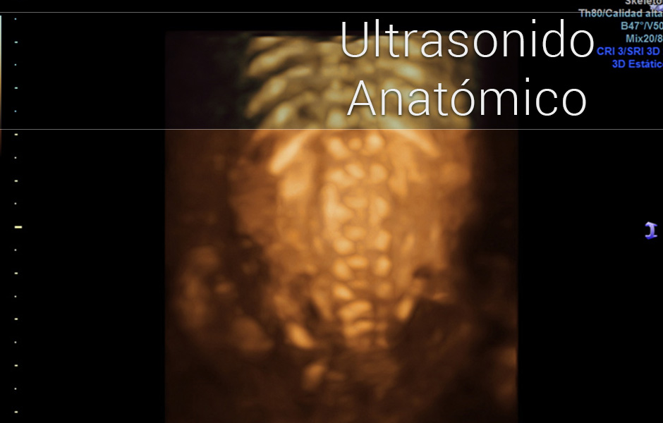 Ultrasonido Anatómico